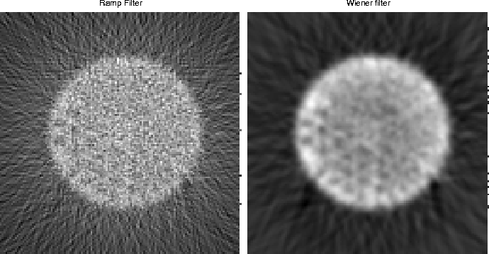 wiener-filter-matlab